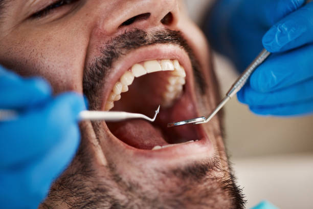 Best Emergency Treatment for Dental Infections or Abscesses in Stone Park, IL