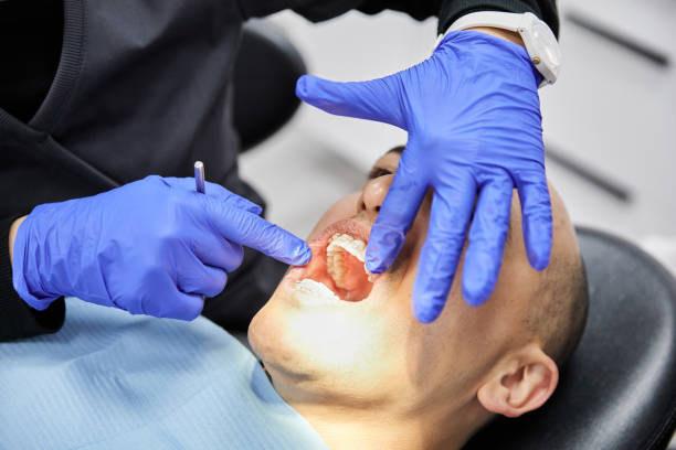 Best Emergency Dental Care for Broken or Chipped Teeth in Stone Park, IL